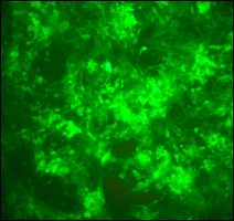 SL016 (HCC70 Breast Cancer Cell Line)